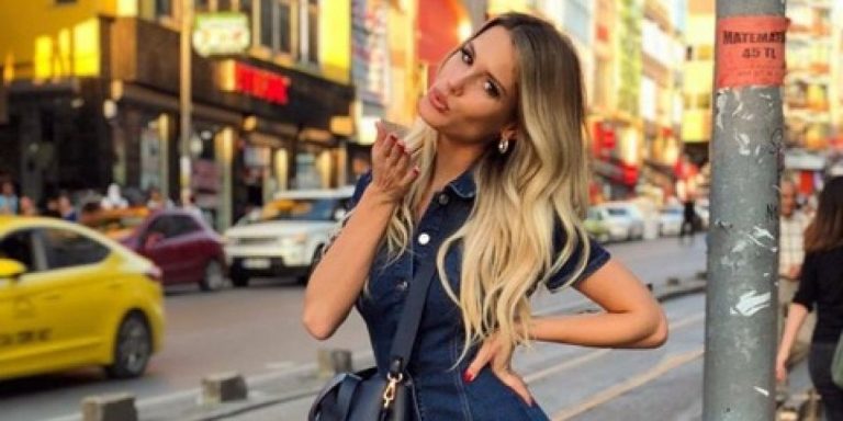 Gala Caldirola se llena de críticas por retoque en su boca