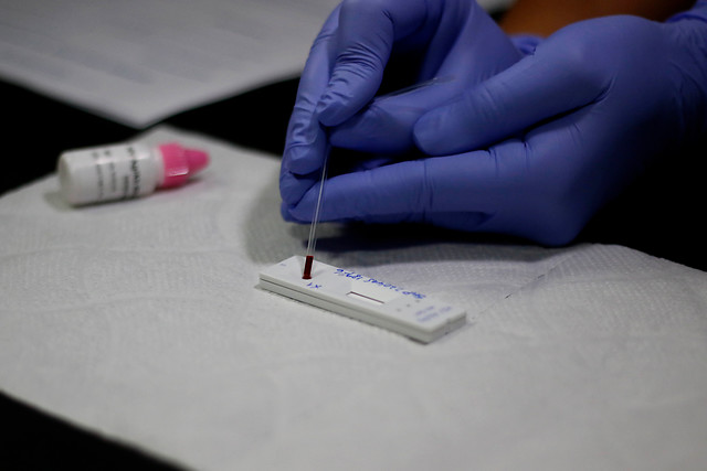 Minsal se pone en alerta tras detectar más de 3.500 nuevos casos de VIH