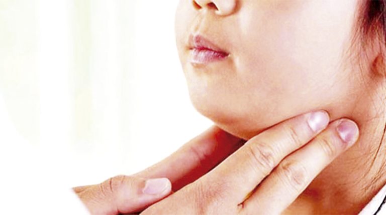 ¡Ojo! Ya van más de 1.600 casos de paperas en la región del Bío Bío