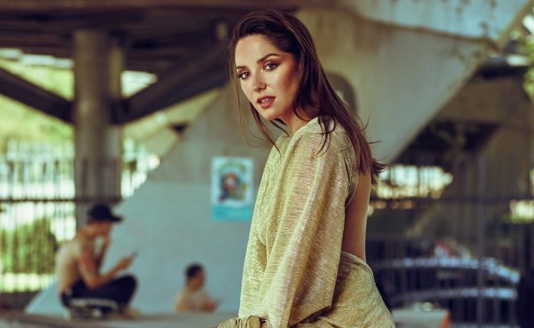 Kel Calderón luce personalizada bota ortopédica tras fracturarse el pie