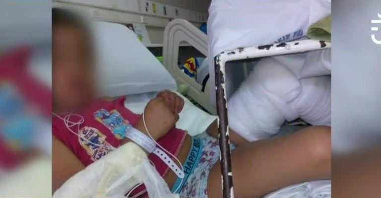 Niño de cinco años sufrió grave accidente en Parque Quinta Normal