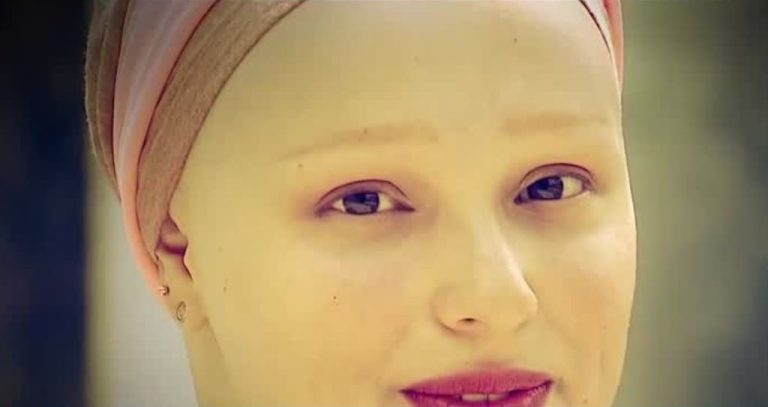Una lucha por recuperar la femeneidad: ¿Cómo viven las mujeres con alopecia?
