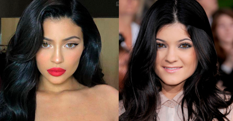 Kylie Jenner negó haberse sometido a cirugías y que nunca lo haría