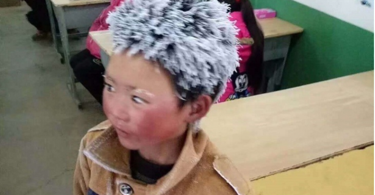 Esta es la nueva vida del niño que hizo conocido por su pelo congelado