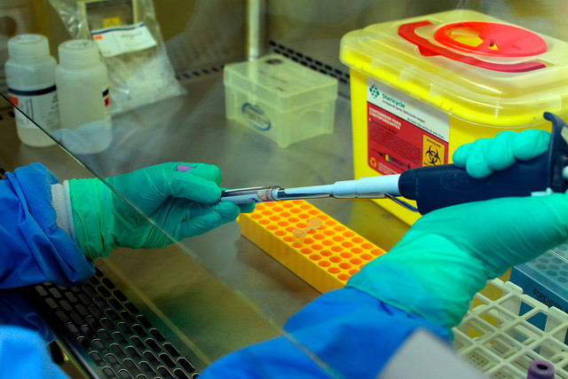 Guagua de 25 días contrajo el virus Hanta: 