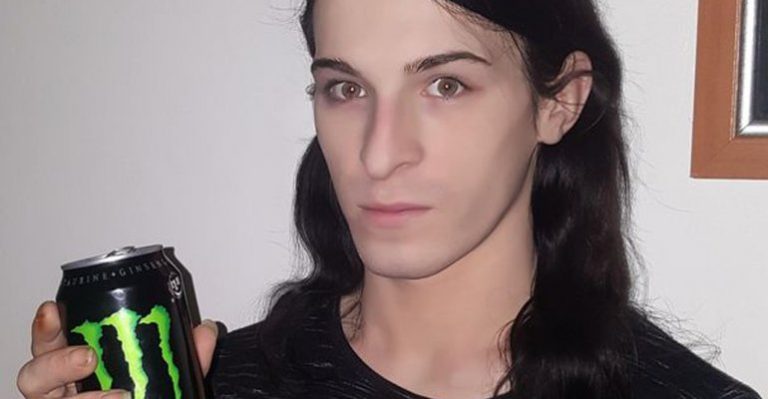 Joven perdió sus dientes por adicción a las bebidas energéticas