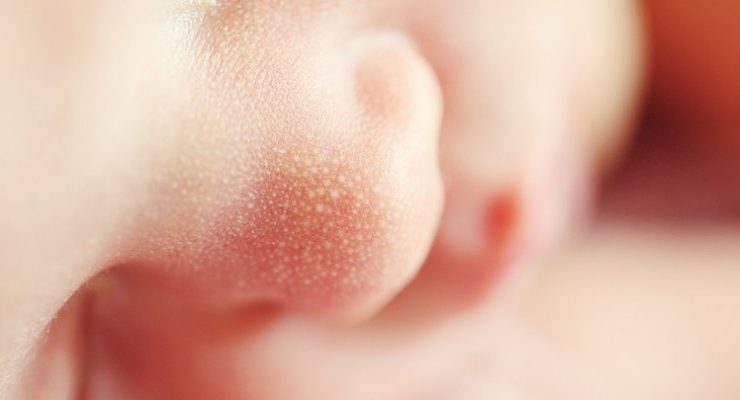 Nuevos antecedentes apuntan a que guagua internada en Hospital de Talca no se habría comido pito de marihuana