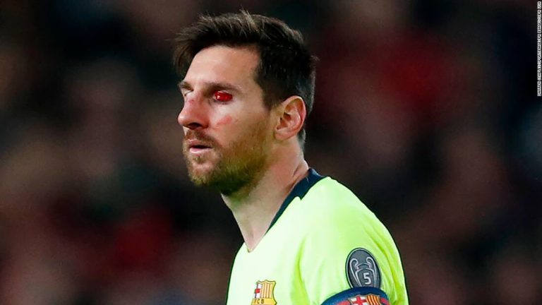 El violento golpe en el rostro que recibió Messi y que lo dejó sangrando en pleno partido de la Champions