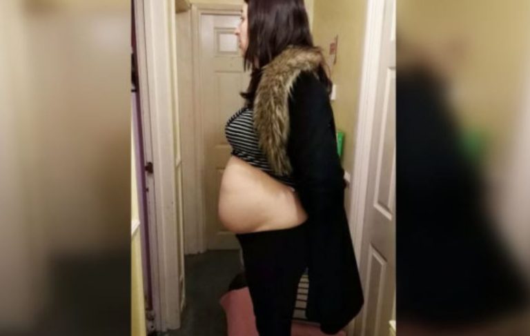 Pensó que estaba embarazada: El impactante diagnóstico de una mujer que tenía un tumor de 40 cm en su ovario