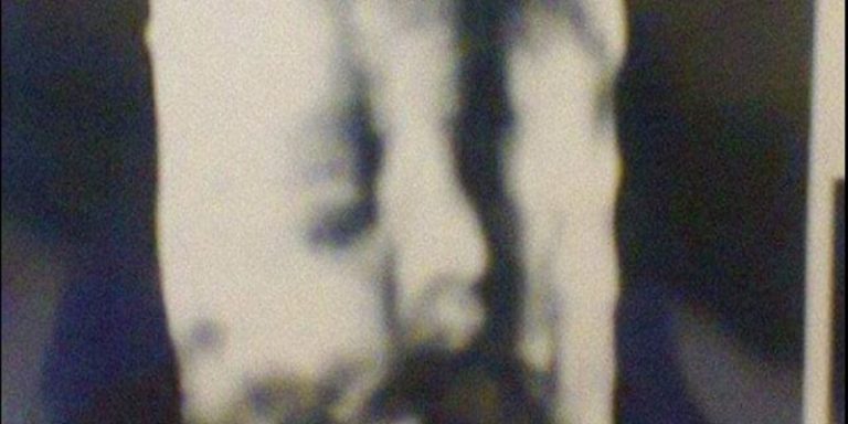 Mujer denuncia que doctor le entregó la misma ecografía que había pasado a otra paciente embarazada