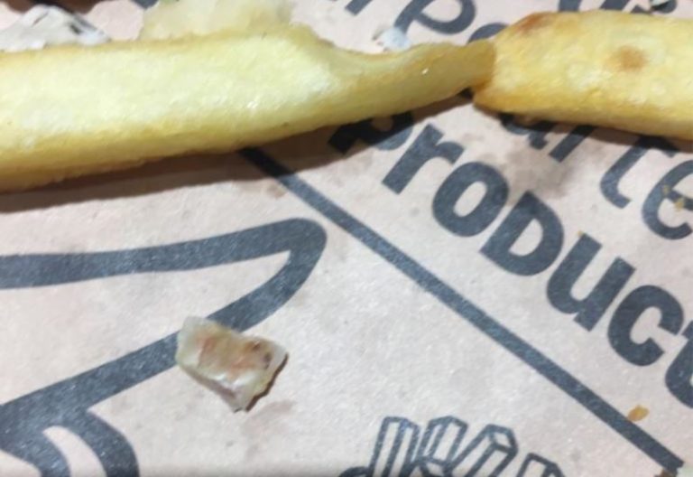 Todo mal: Cliente pidió empanadas en local de comida rápida y le salió un diente humano