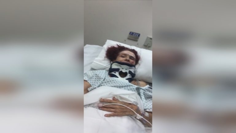 Shlomit Baytelman fue operada tras ser atropellada por un ciclista: “Estoy mucho peor de lo que pensaba”