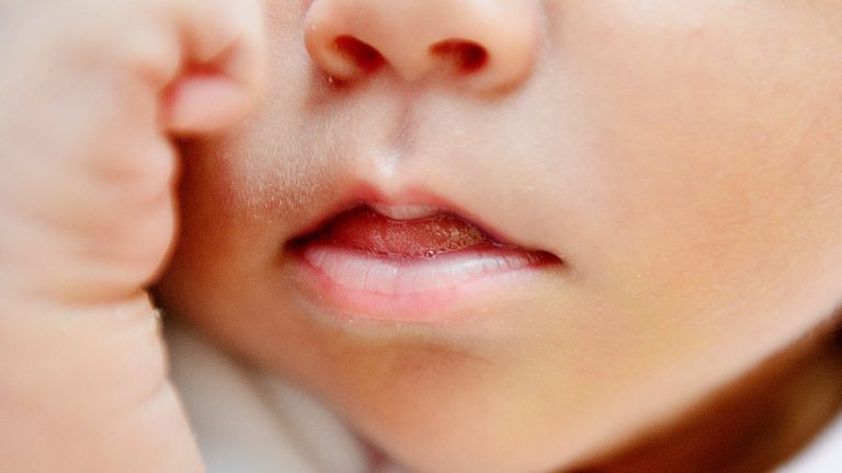 Niño de 1 año y 7 meses quedó internado tras comerse un pito de marihuana: Los padres serán investigados