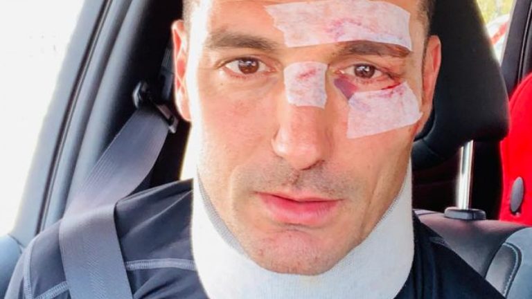 Lionel Scaloni fue atropellado mientras iba en bicicleta por Mallorca