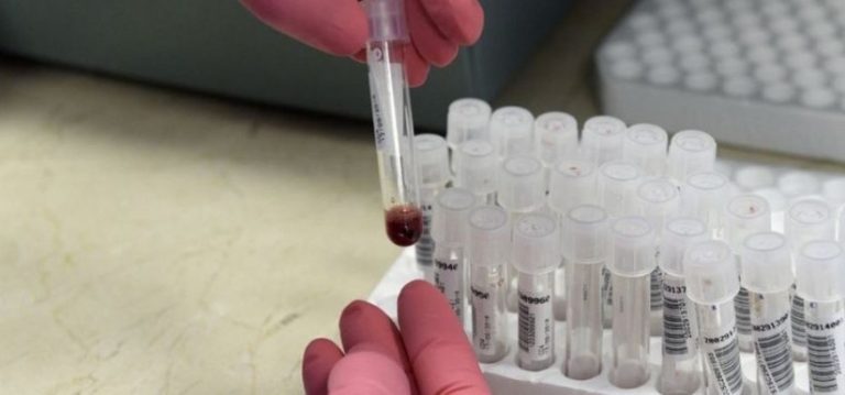 Estudio indica que tratamiento contra VIH elimina riesgo de transmisión