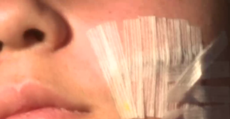 Menores encapuchadas le cortaron la cara a compañera al interior de colegio