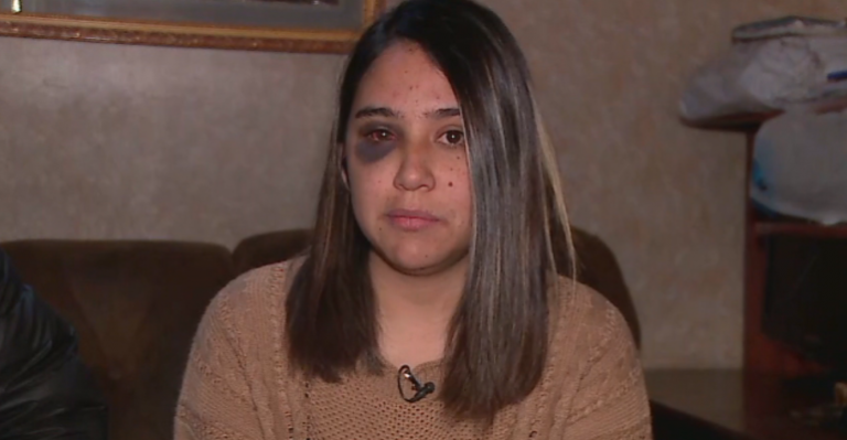 Testimonio: Joven fue agredida en plena calle por su ex pareja