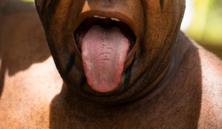 ¡De un mordisco! Doctora le sacó la lengua a hombre que intentó violarla