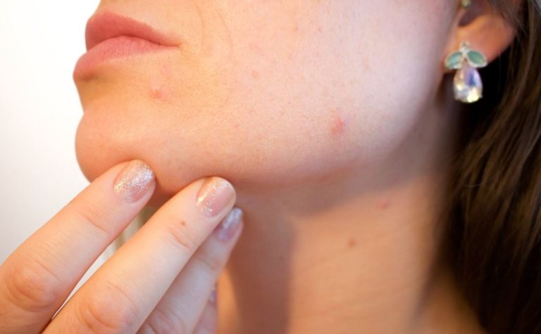 Ojo con la calefacción y los cambios de temperatura: 5 efectivos consejos para cuidar tu piel en invierno