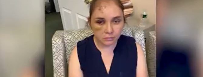 Mujer es golpeada por defender a su hijo de burlas anti-inmigrantes