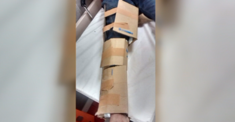 Paciente denunció que inmovilizaron su pierna con cartón en Hospital público