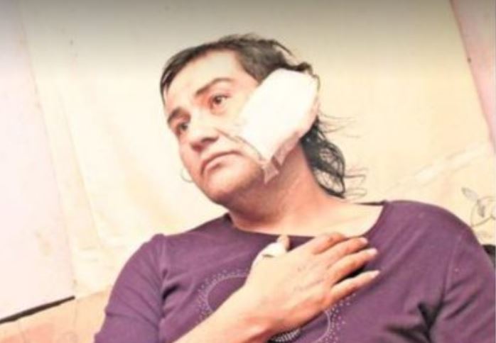 Movilh denuncia ataque transfóbico con machete contra mujer que hizo dedo en Ñuble