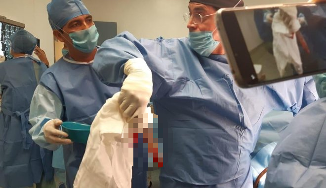 Discusión por un estacionamiento terminó con un hombre apuñalado en el ojo