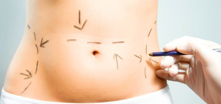 Diputado propone que chilenos tengan acceso a cirugía plástica gratuita hasta una vez en la vida