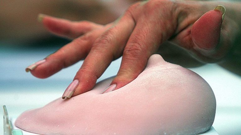 ¿Puede aumentar el riesgo de cáncer mamario si me someto a un implante?