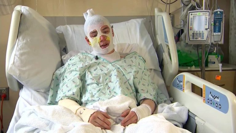 Sufrió graves quemaduras por salvar de un incendio a sobrina de 8 años y ahora lo llaman el “tío héroe”