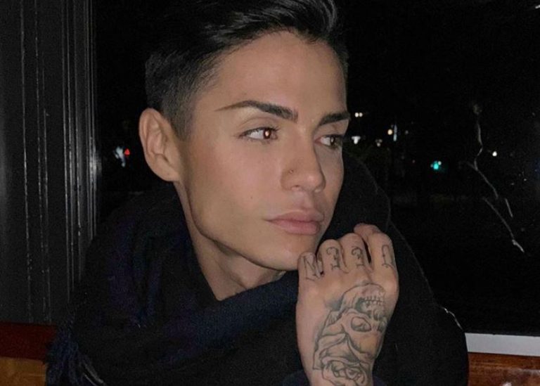 Leo Méndez Jr. publicó imagen tras ser golpeado y funó al supuesto agresor