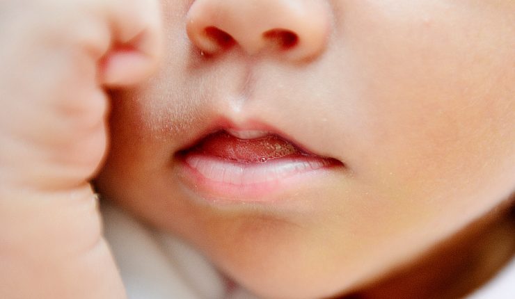 Bebé se encuentra en riesgo vital tras recibir un disparo en su cabeza