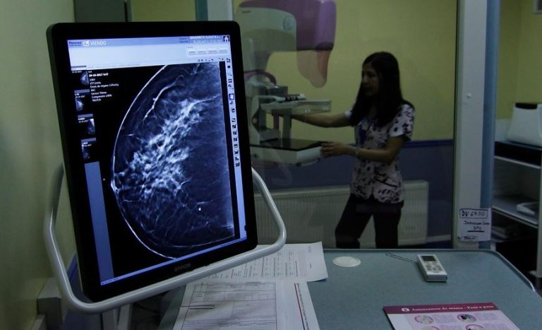 Esta es la forma de detectar el cáncer de mamas que probablemente no conocías