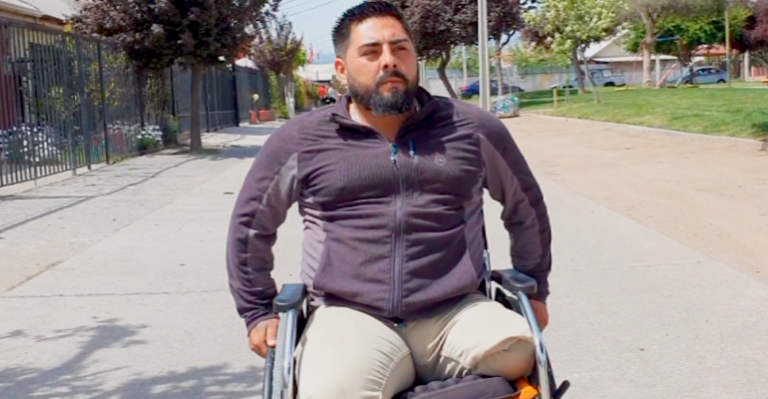 Joven perdió su pierna tras mal diagnóstico médico