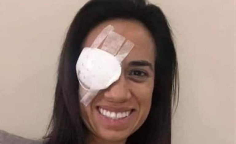 Diputada Núñez aclaró por qué circula una foto de ella con un parche en el ojo