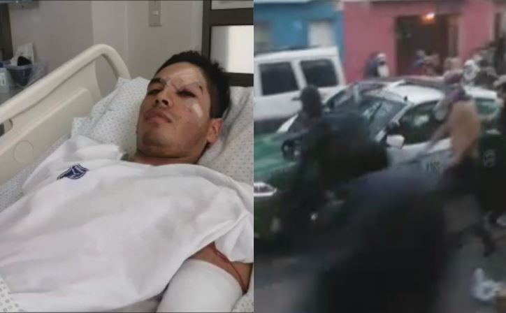 Habla carabinero herido tras ataque a patrulla: “Lo único que pensaba era que iba a dejar a mi esposa sola”