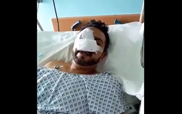 “Voy a perder mi ojo”: Hombre acusó haber recibido una lacrimógena en su rostro cuando salía del trabajo