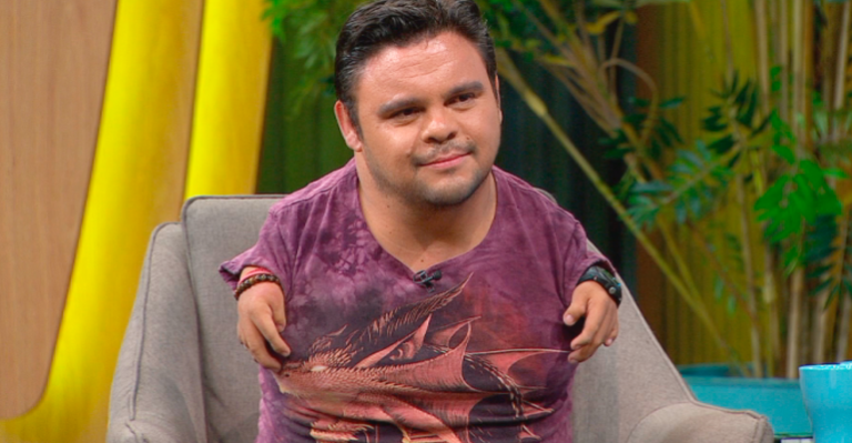 Oscarito confesó cómo reaccionaron sus padres al descubrir su malformación