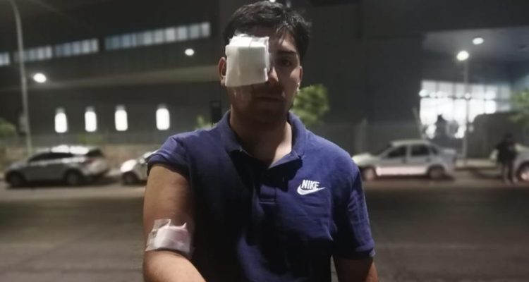 Joven denunció herida ocular por perdigón durante manifestación en La Granja