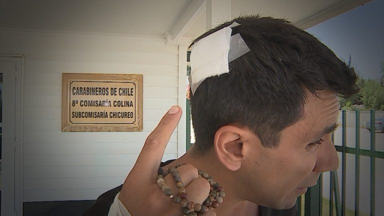 “Parecía película”: El relato de Juan Pablo Queraltó tras sufrir violento robo