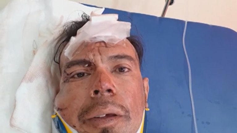 “Gracias a Dios estoy aquí para contarlo”: Pasajero que sobrevivió a accidente en Taltal entregó su testimonio