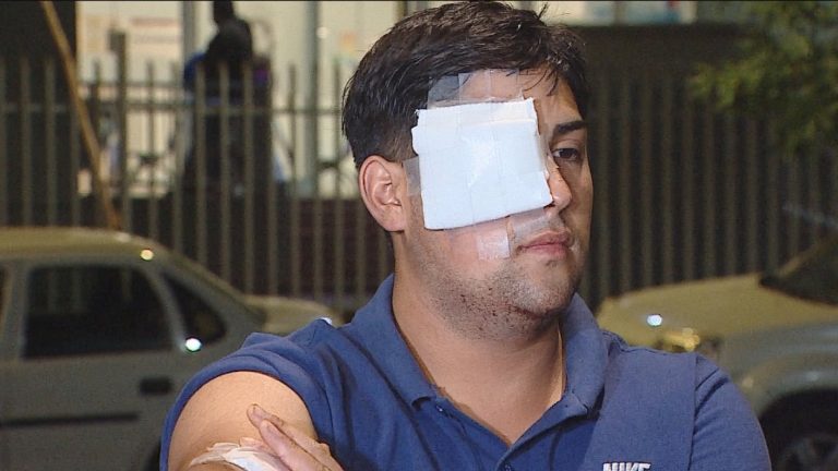 Fue operado, pero aún no se sabe si recuperará la vista: Joven fue herido con perdigón en su ojo en La Granja