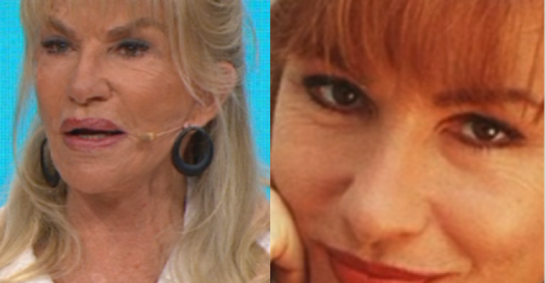 Sandra Solimano sobre cirugía: “Me hice un relleno que se encapsuló y me deformó la cara”