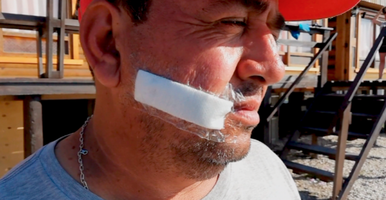 Tiene 20 puntos en el rostro: Hombre fue herido por carro lanza aguas dentro de peluquería