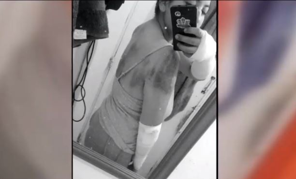 Joven acusa que conductor de Uber intentó secuestrarla: Se lanzó del auto en movimiento