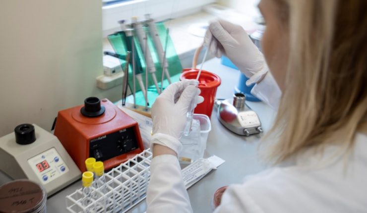 Revelaron imágenes de los pulmones de primeros casos de coronavirus en Italia