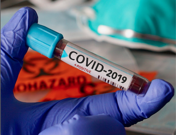 ¿Cómo puede llegar a causar la muerte el coronavirus?