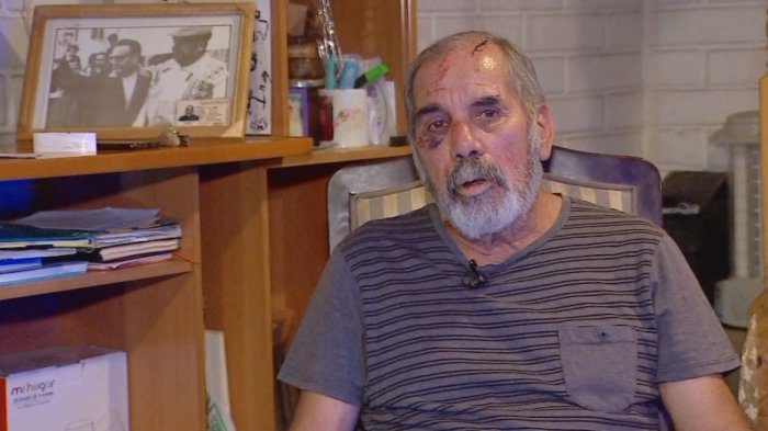 Denuncian procedimiento policial donde se golpea a un adulto mayor