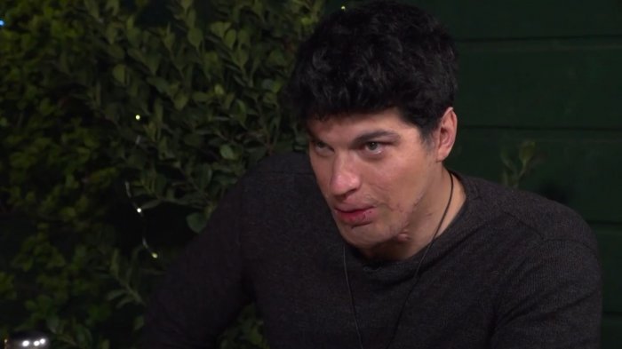 La cruda confesión que hará Ignacio Lastra en la Divina Comida tras su accidente