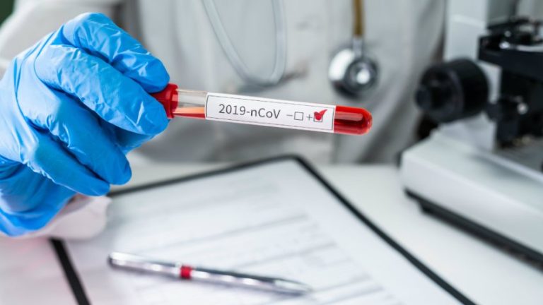 Más de 2 millones de casos confirmados y 160.717 muertes por COVID-19 en el mundo